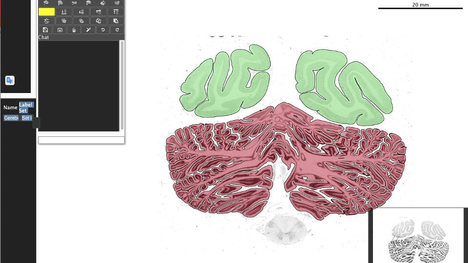 Image of a 20 micrometer histological section of a gorilla brain with sections in green and red.