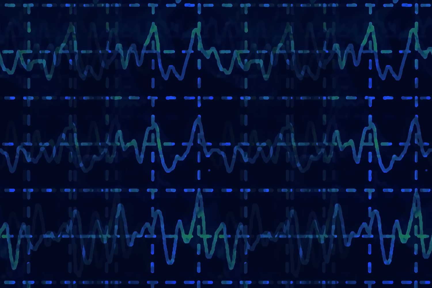 Wave oscillations on a dark background
